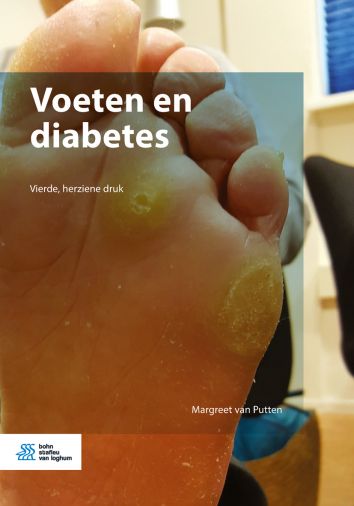 Voorkant - Voeten en diabetes