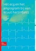 Voorkant - Het ECG en het angiogram bij een acuut hartinfarct