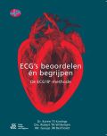 Voorkant - ECG's - beoordelen én begrijpen