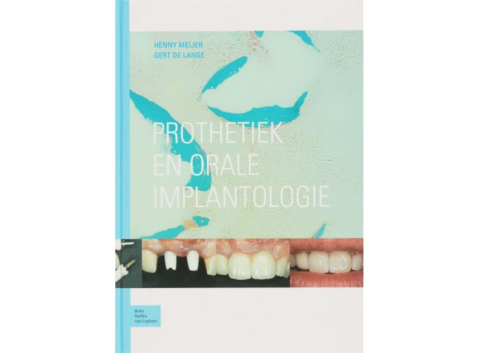 Voorkant - Prothetiek en orale implantologie