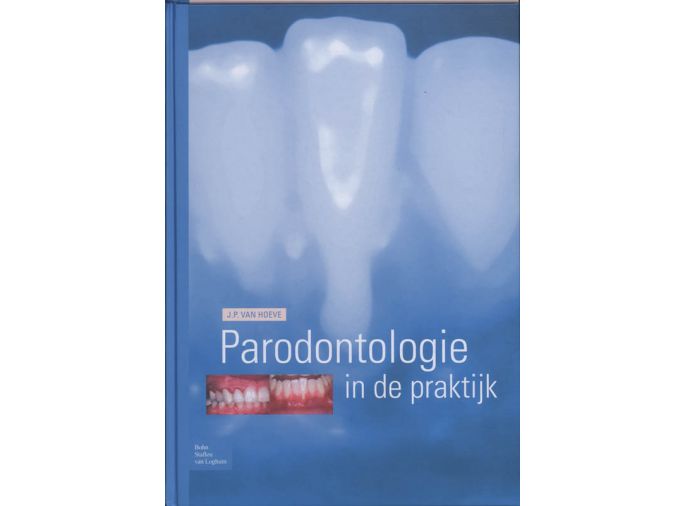 Voorkant - Parodontologie in de Praktijk