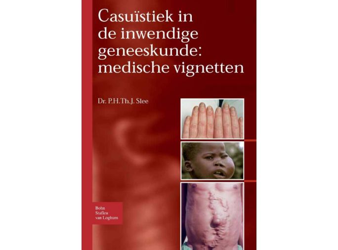 Voorkant - Casuïstiek in de inwendige geneeskunde: medische vignetten