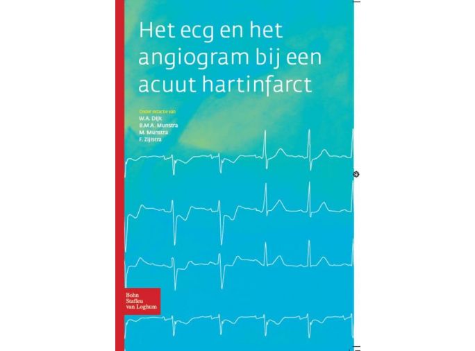 Voorkant - Het ECG en het angiogram bij een acuut hartinfarct