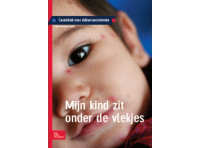 Voorkant - Mijn kind zit onder de vlekjes
