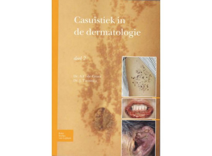Voorkant - Casuïstiek in de dermatologie