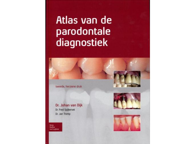 Voorkant - Atlas van de parodontale diagnostiek