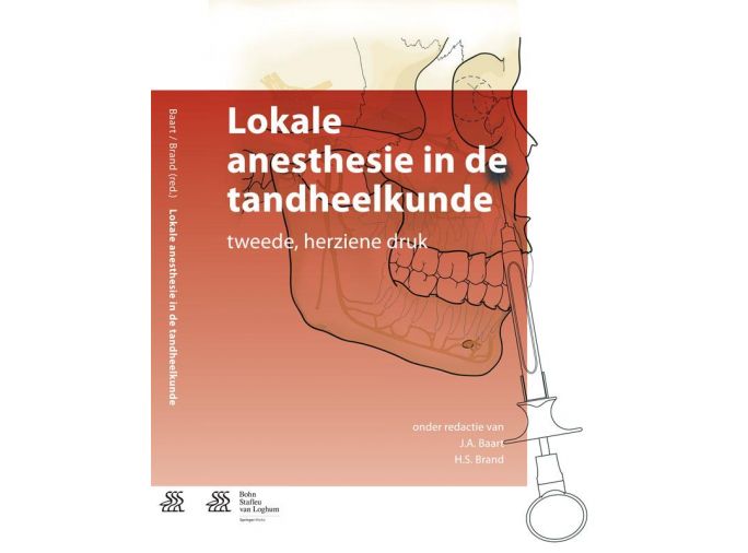 Voorkant - Lokale anesthesie in de tandheelkunde