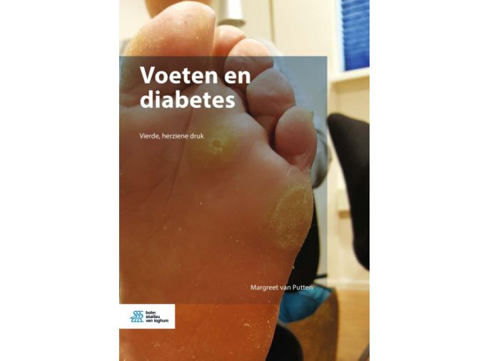 Voorkant - Voeten en diabetes
