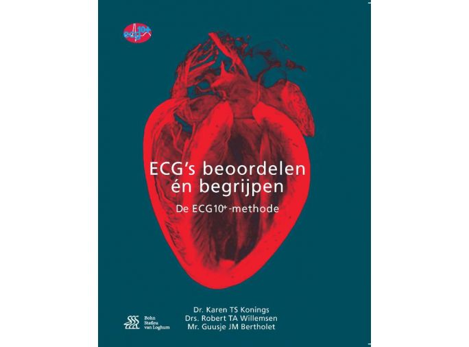 Voorkant - ECG's - beoordelen én begrijpen