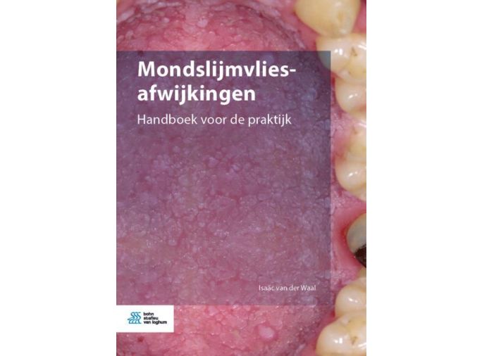 Voorkant - Mondslijmvliesafwijkingen