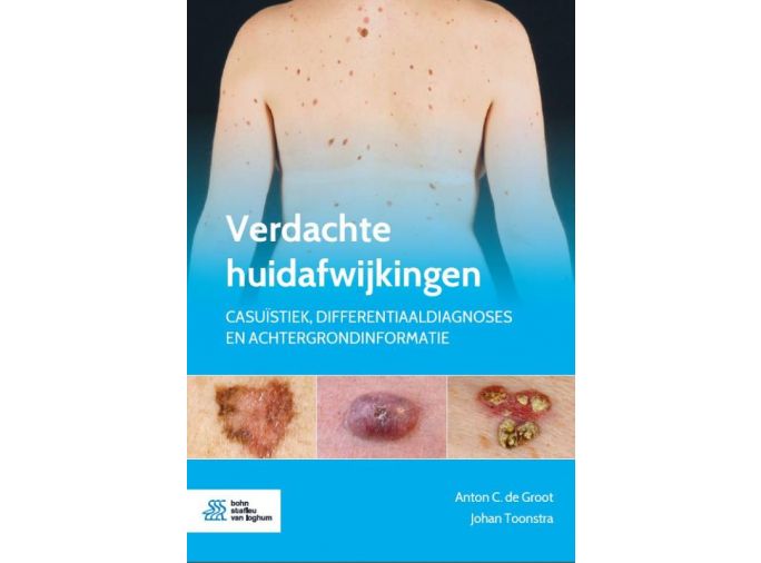 Voorkant - Verdachte huidafwijkingen