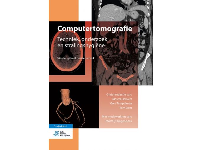 Voorkant - Computertomografie
