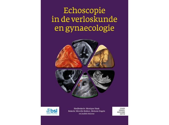 Voorkant - Echoscopie in de verloskunde en gynaecologie