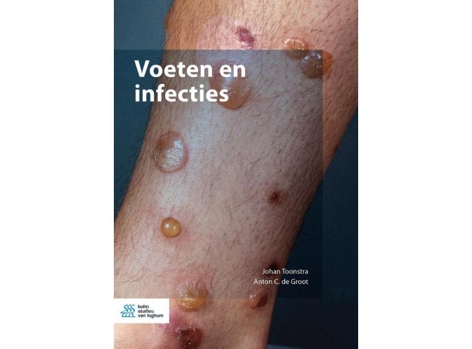 Voorkant - Voeten en infecties